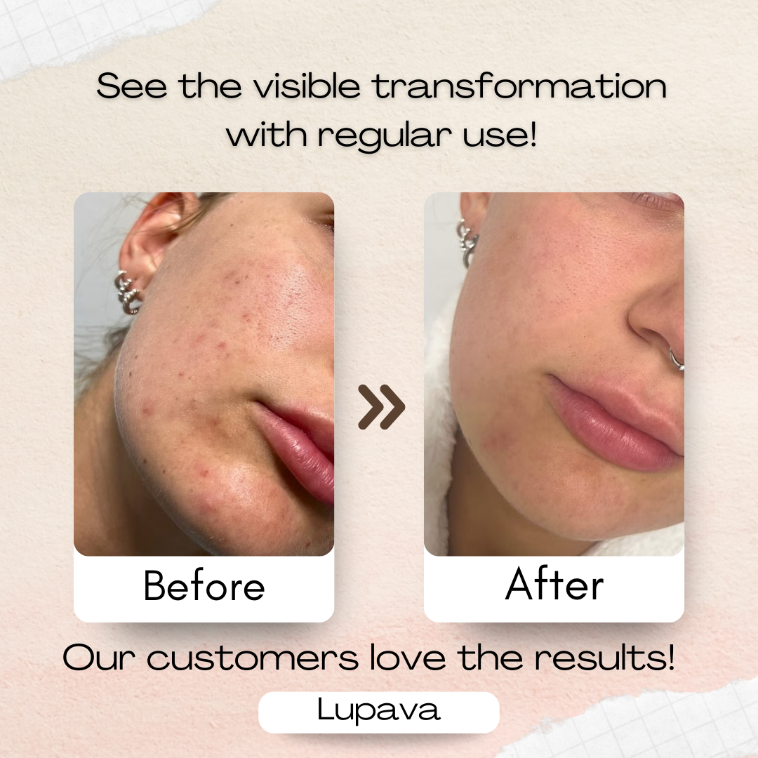 Lupava™ Beauty Mask